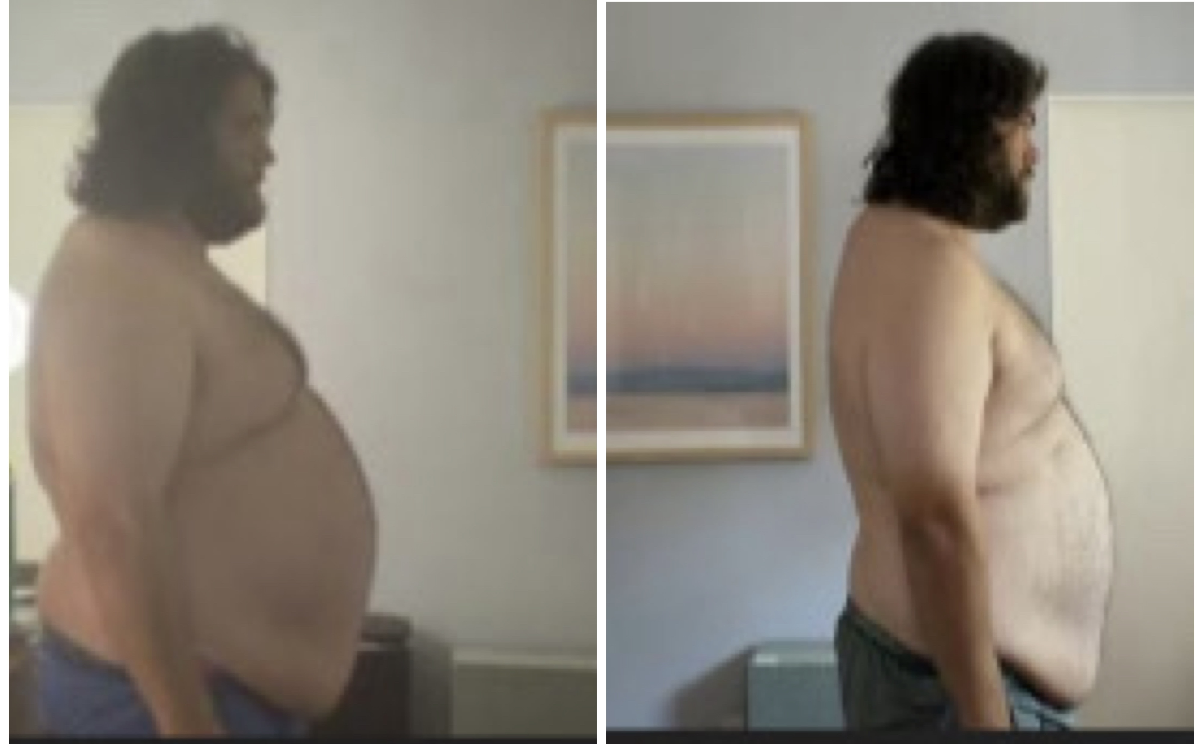 Larry before and after