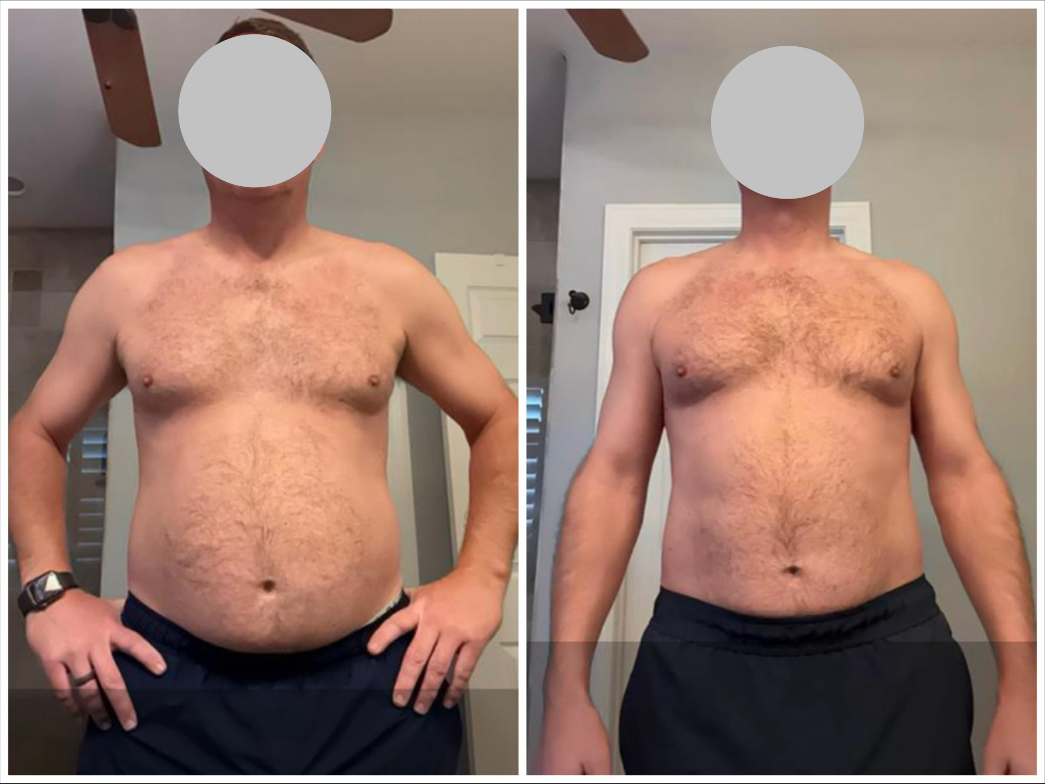 Matt before and after